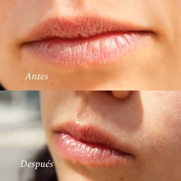 Antes y después de aplicar el bálsamo de aloe vera Kamel